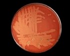 Streptococcus agalactiae, group B